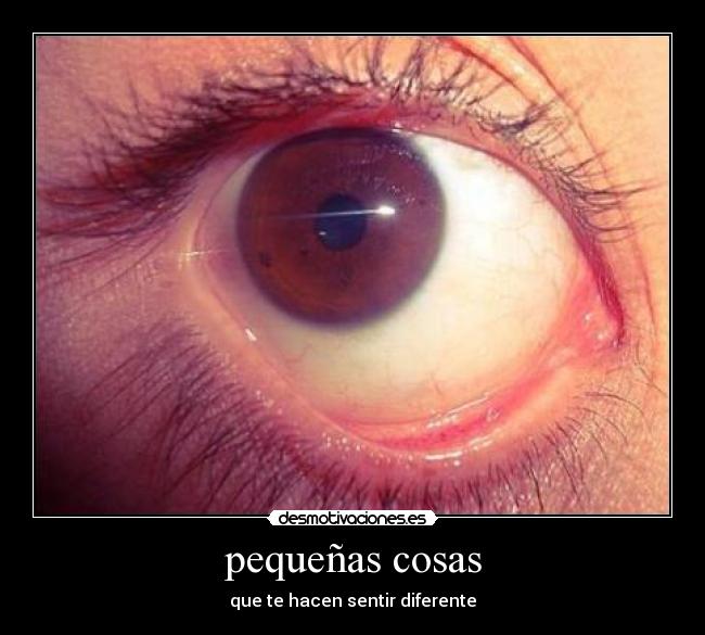 pequeñas cosas - que te hacen sentir diferente