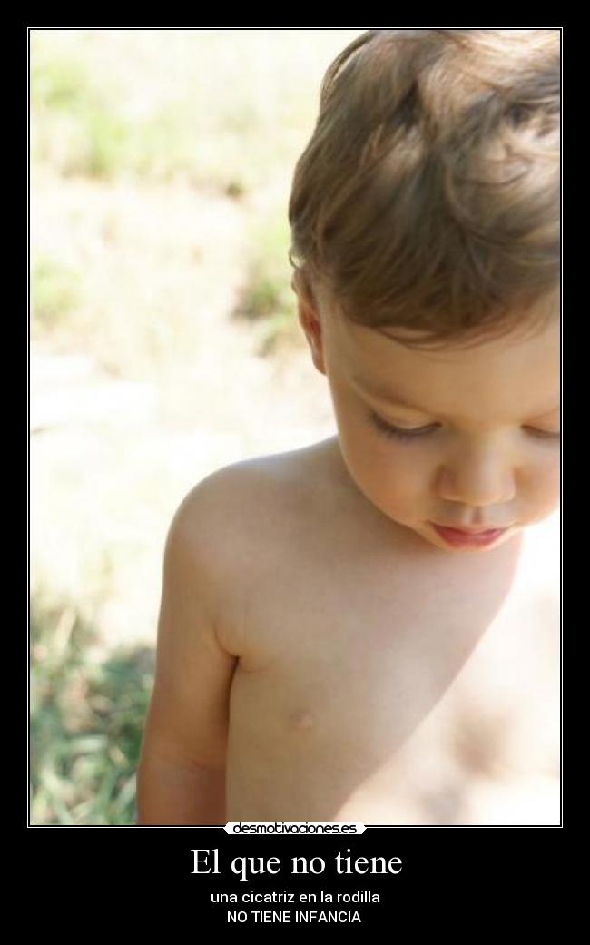 El que no tiene - una cicatriz en la rodilla
NO TIENE INFANCIA 