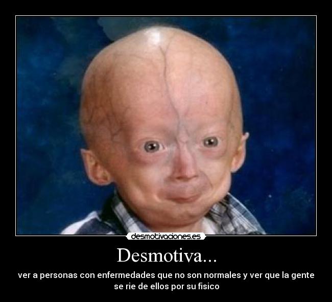 Desmotiva... - ver a personas con enfermedades que no son normales y ver que la gente
se rie de ellos por su fisico