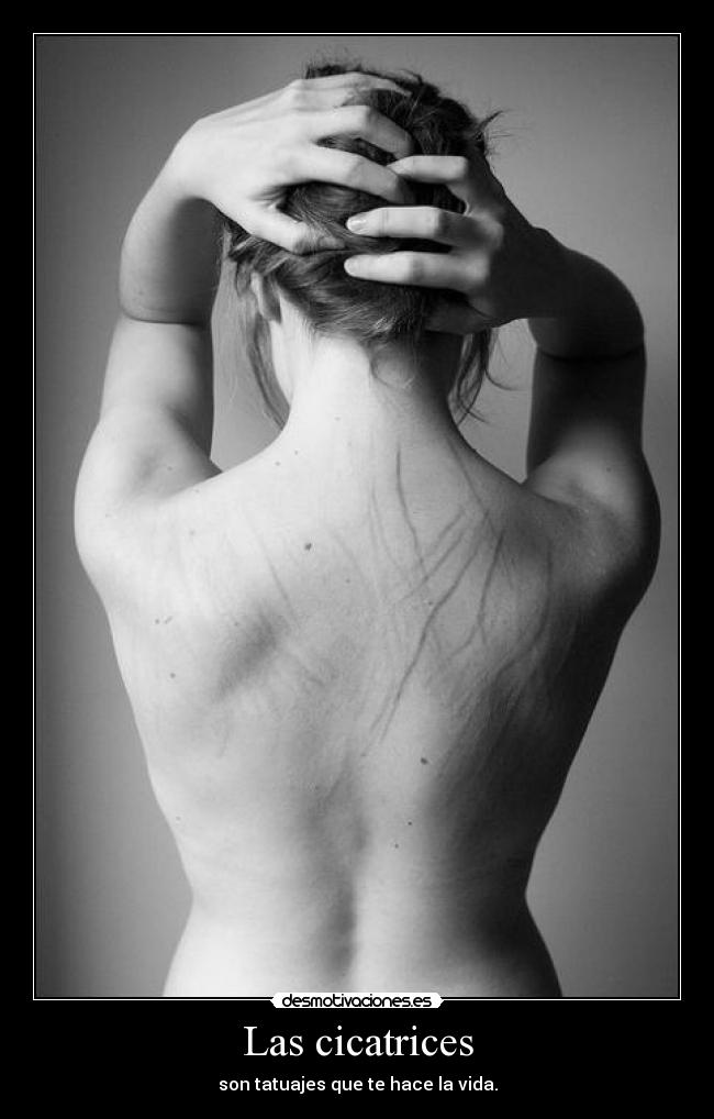 carteles las cicatrices desmotivaciones