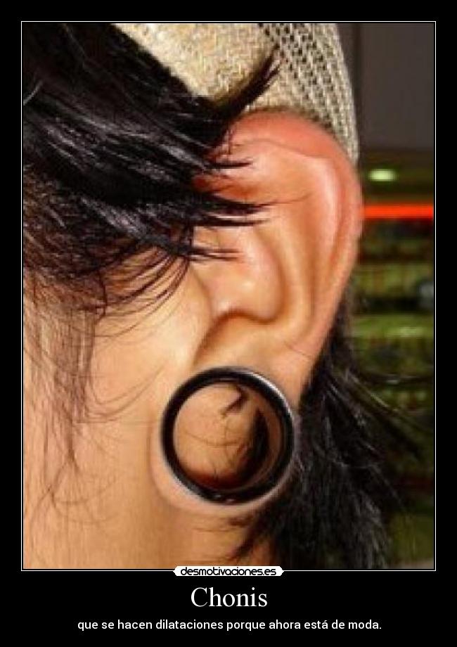 carteles chonis dilataciones desmotivaciones