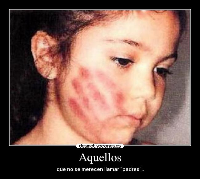 Aquellos -