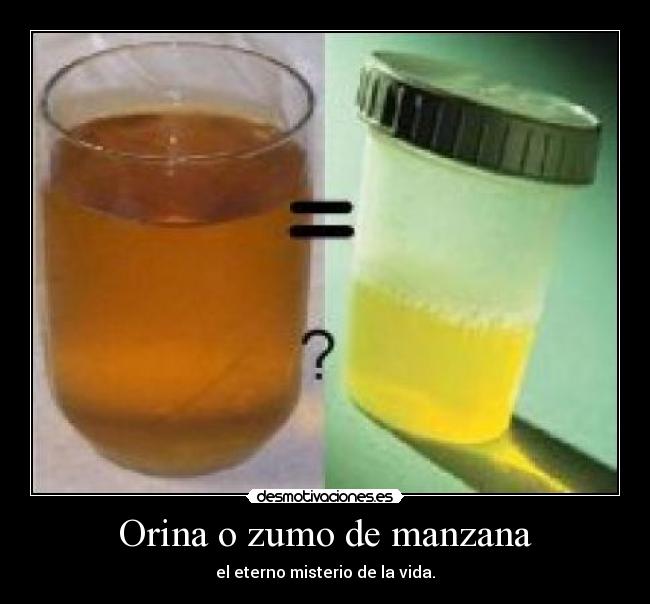 Orina o zumo de manzana -