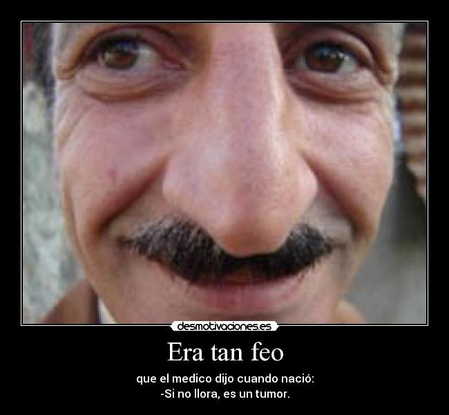 Era tan feo - que el medico dijo cuando nació:
-Si no llora, es un tumor.