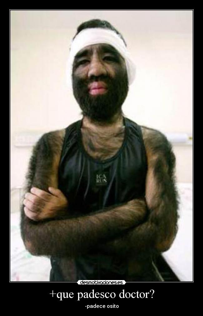 +que padesco doctor? - -padece osito