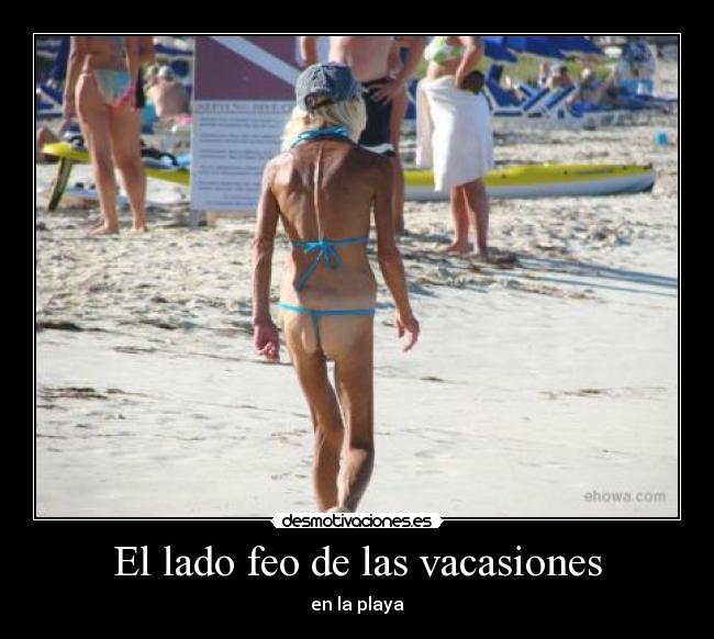 El lado feo de las vacasiones - en la playa