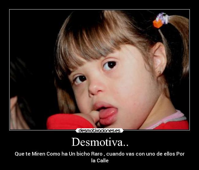 Desmotiva.. - Que te Miren Como ha Un bicho Raro , cuando vas con uno de ellos Por la Calle