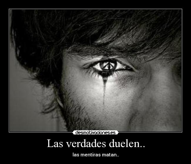 Las verdades duelen.. -