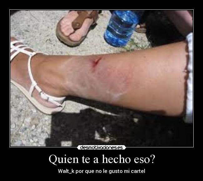 Quien te a hecho eso? -