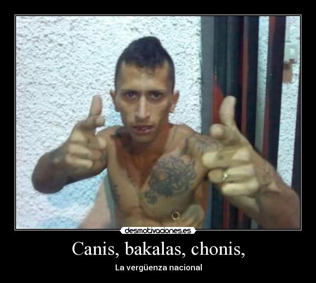 Canis, bakalas, chonis, - La vergüenza nacional