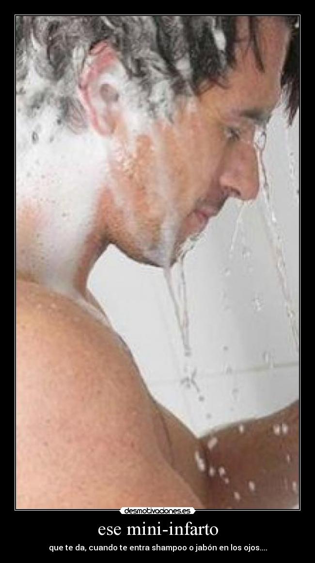 ese mini-infarto - 