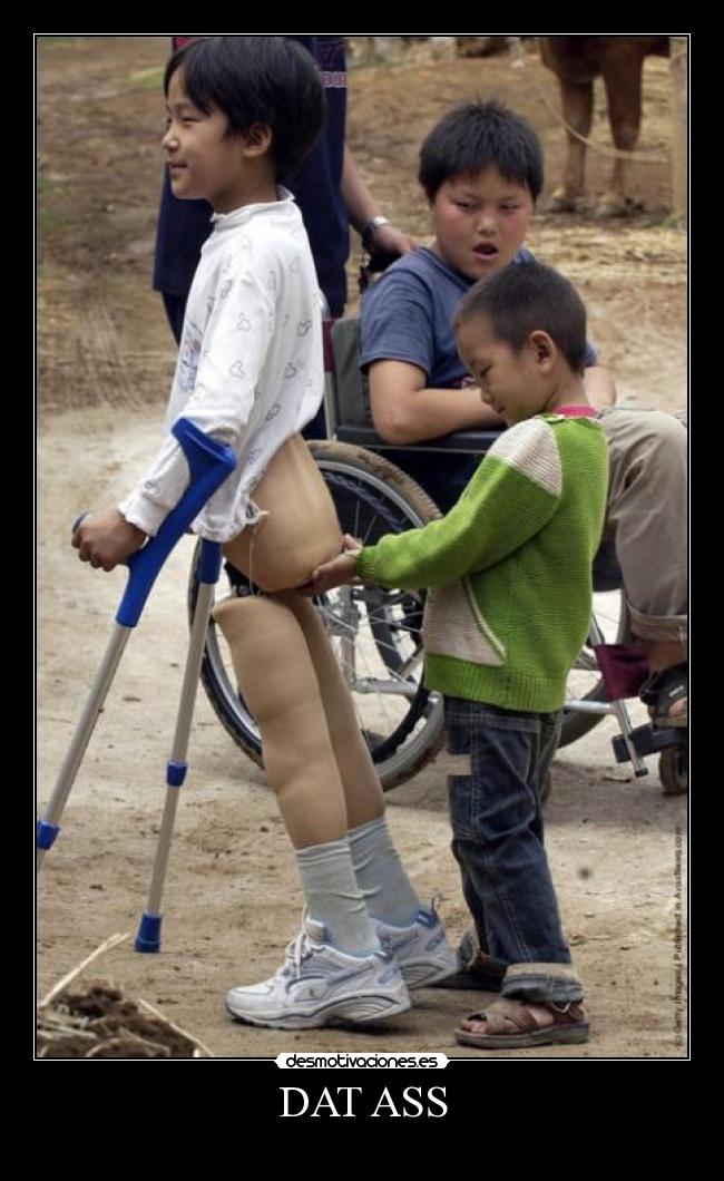 DAT ASS -