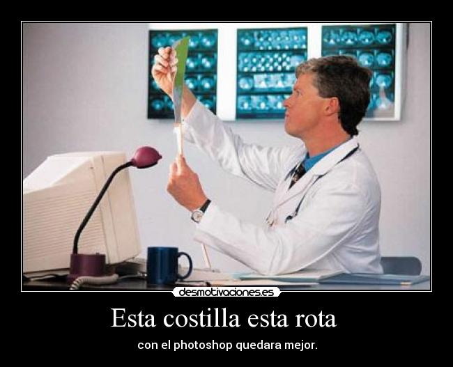 Esta costilla esta rota -