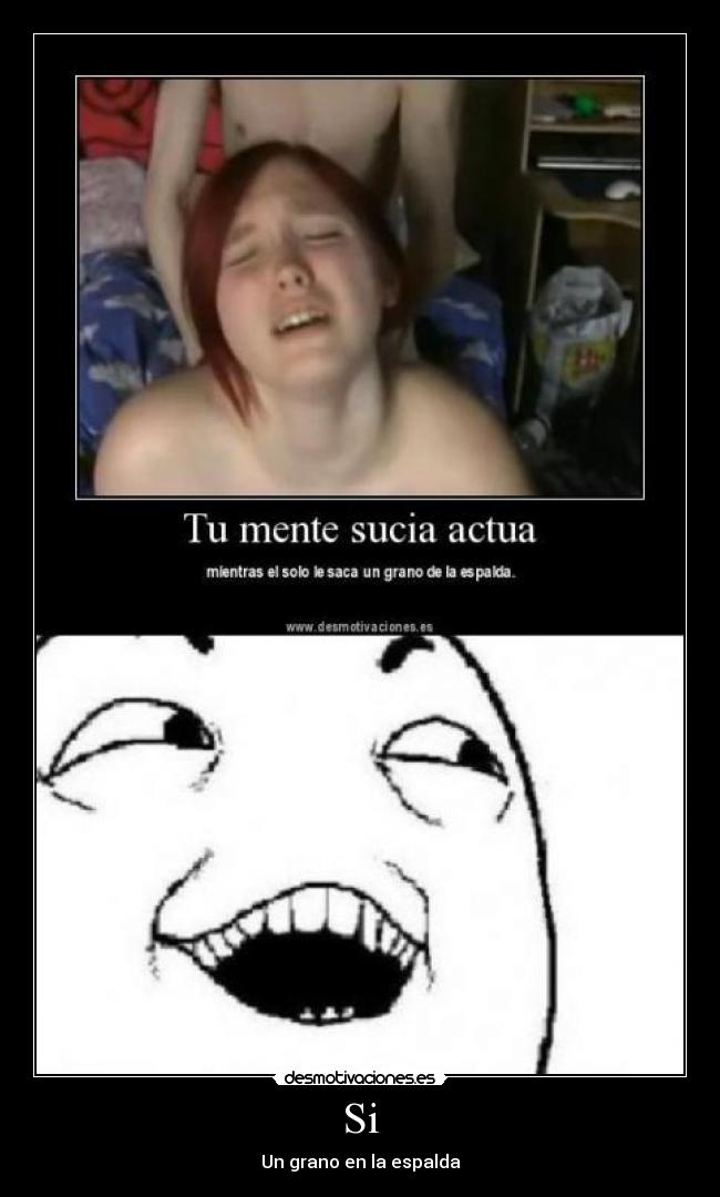 Si - Un grano en la espalda