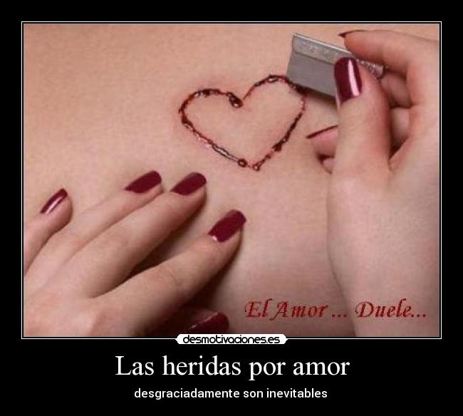 Las heridas por amor - 