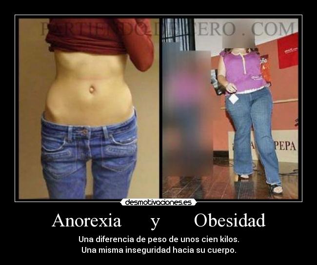 Anorexia y Obesidad - Una diferencia de peso de unos cien kilos.
Una misma inseguridad hacia su cuerpo.