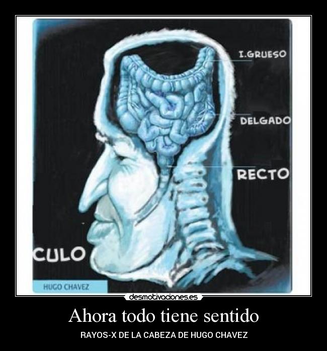 Ahora todo tiene sentido -