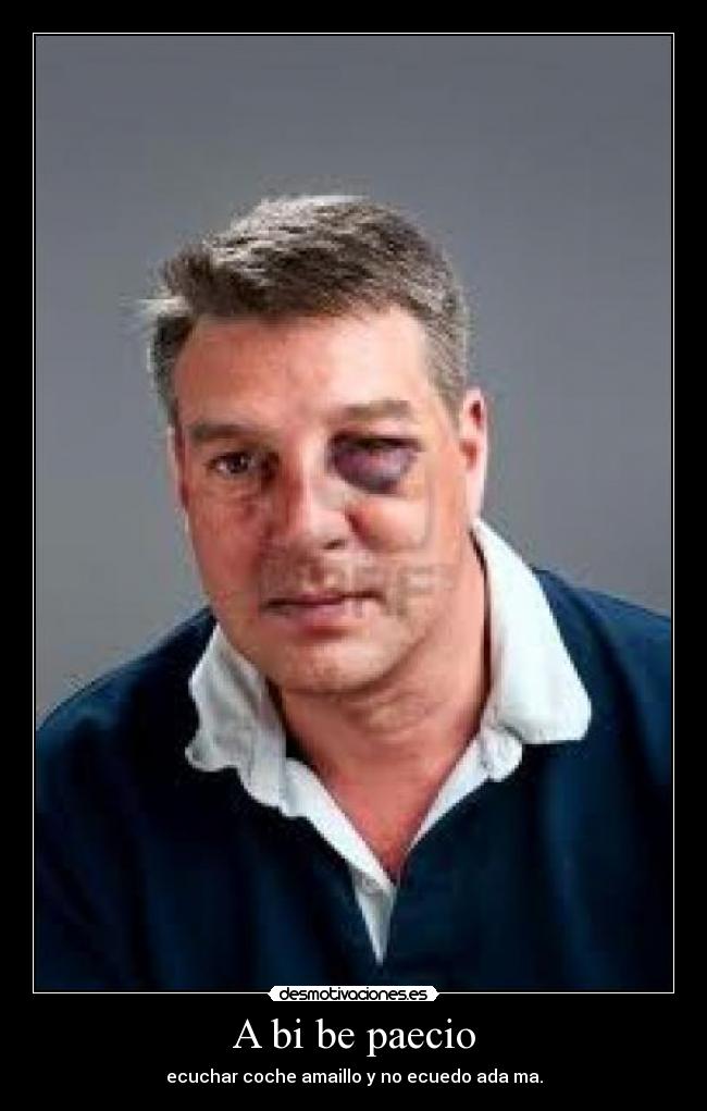 A bi be paecio - ecuchar coche amaillo y no ecuedo ada ma.