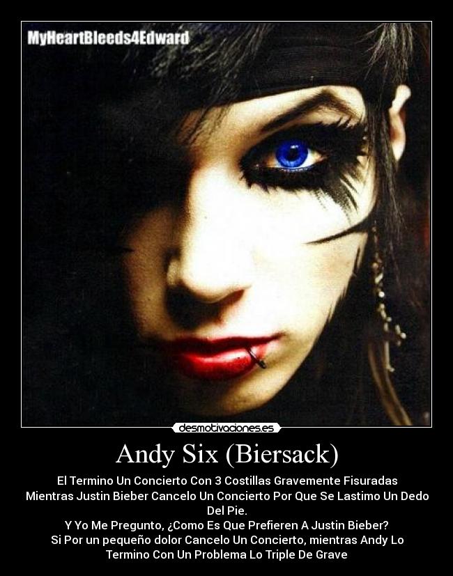Andy Six (Biersack) -