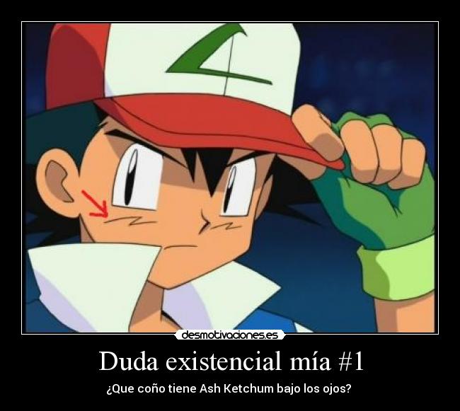 Duda existencial mía #1 - ¿Que coño tiene Ash Ketchum bajo los ojos? 