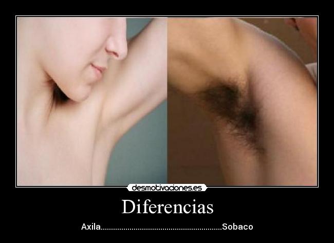 Diferencias -
