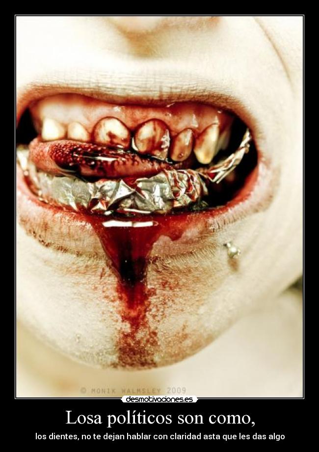 Losa políticos son como, - los dientes, no te dejan hablar con claridad asta que les das algo