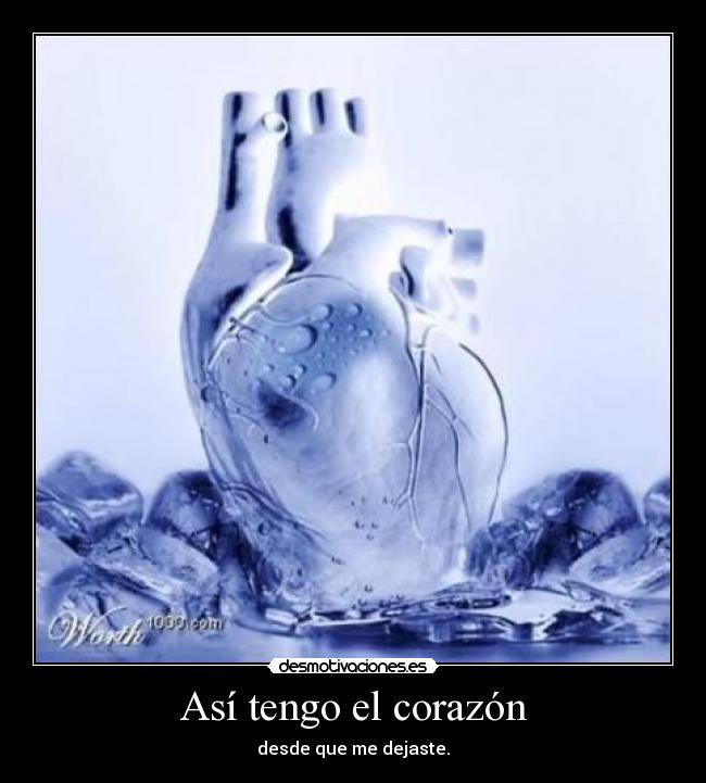 Así tengo el corazón - desde que me dejaste.