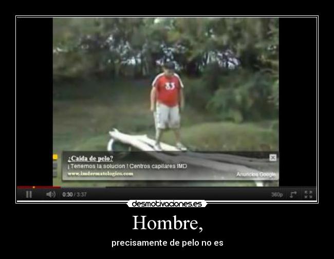 Hombre, - precisamente de pelo no es