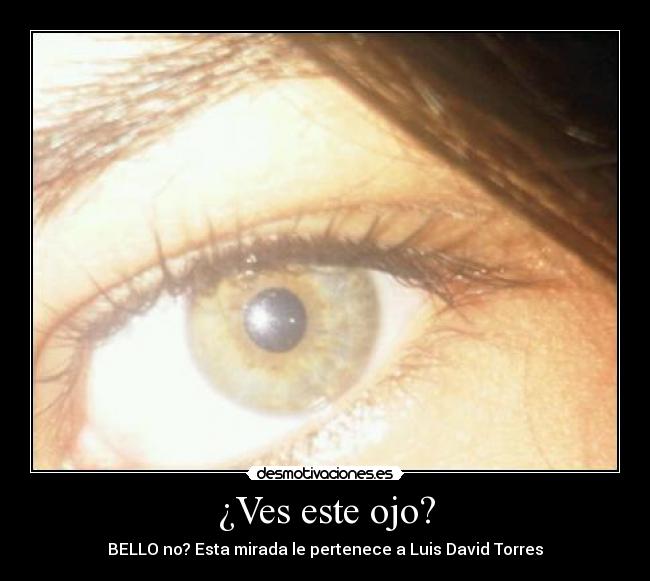 ¿Ves este ojo? - 