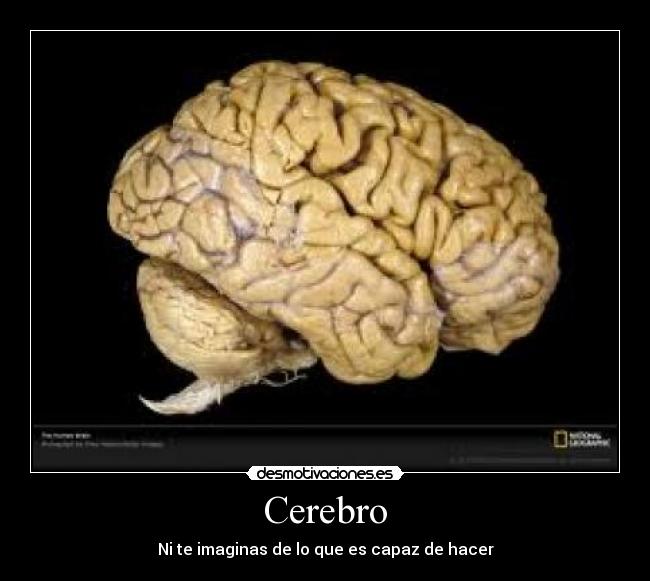Cerebro - 