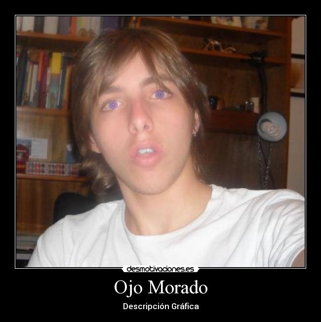 Ojo Morado - 