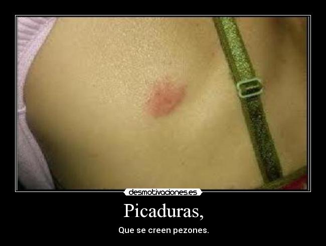 Picaduras, - Que se creen pezones.