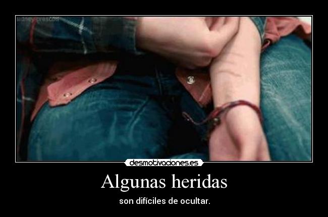Algunas heridas - son difíciles de ocultar.