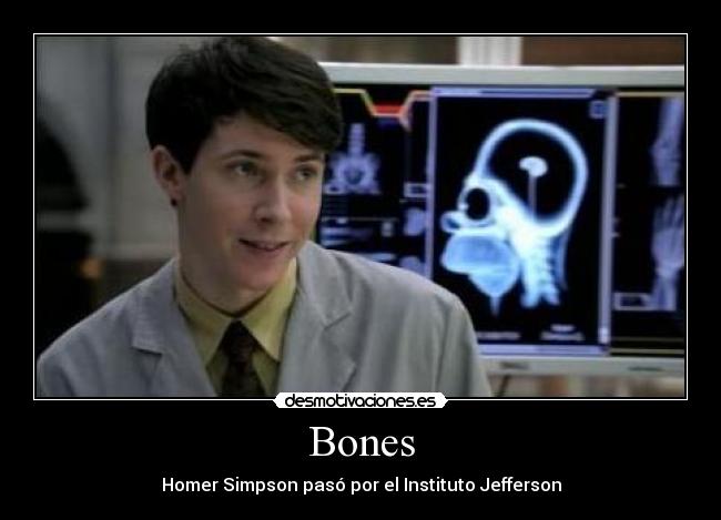 Bones - Homer Simpson pasó por el Instituto Jefferson
