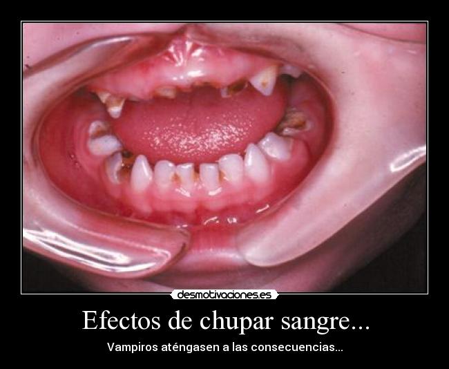Efectos de chupar sangre... - Vampiros aténgasen a las consecuencias...