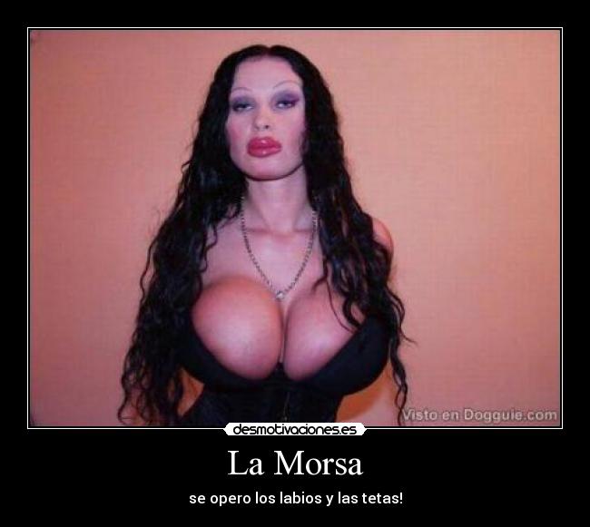 La Morsa - se opero los labios y las tetas!