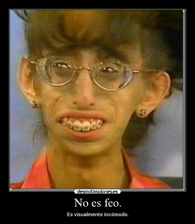 No es feo. - 