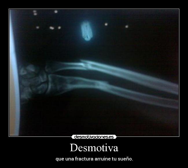 Desmotiva -