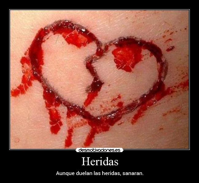 Heridas - Aunque duelan las heridas, sanaran.