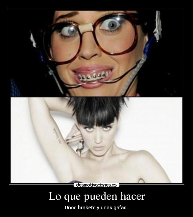 Lo que pueden hacer - Unos brakets y unas gafas..