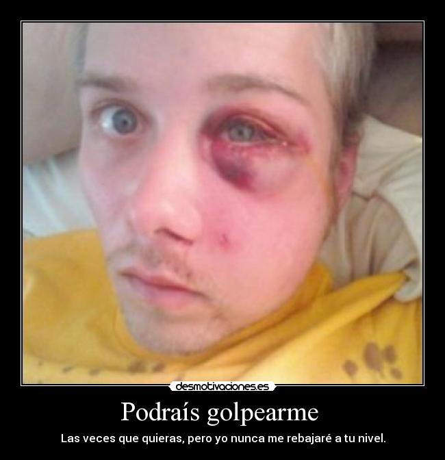 Podraís golpearme  - 