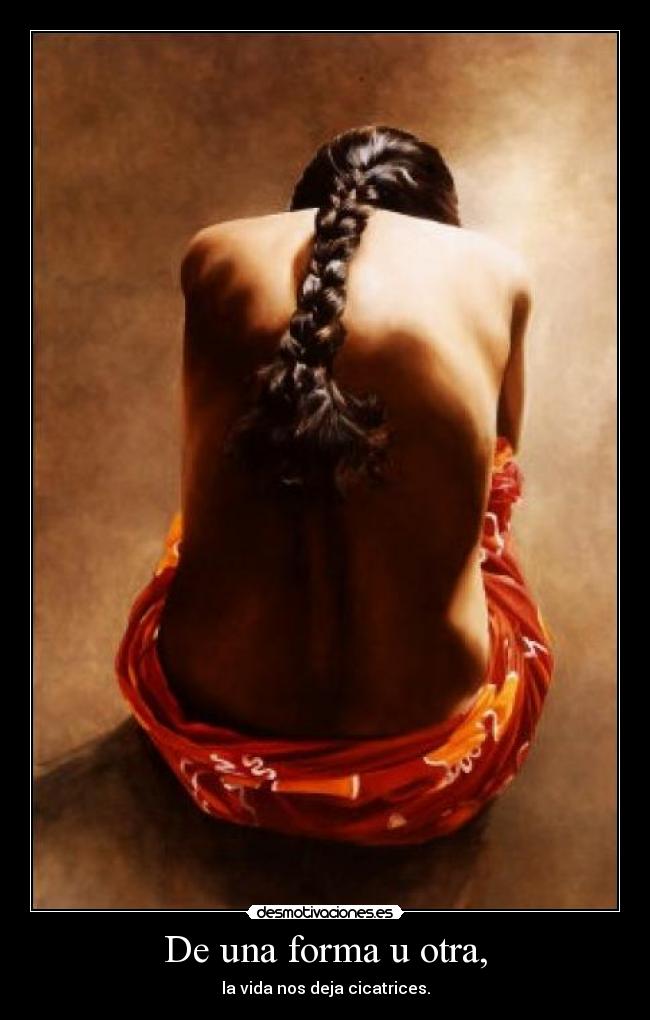 De una forma u otra, - la vida nos deja cicatrices.