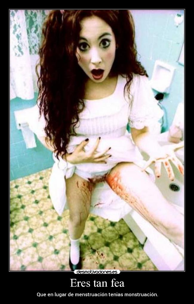 Eres tan fea - 