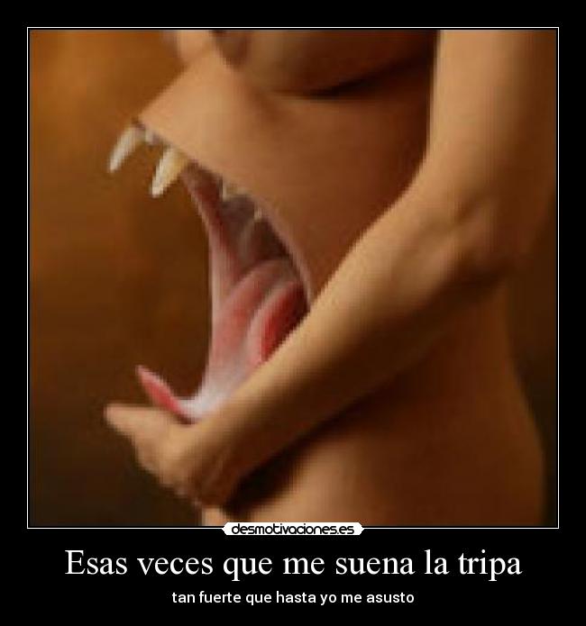 Esas veces que me suena la tripa -