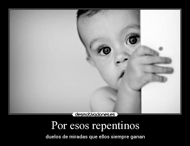 Por esos repentinos - duelos de miradas que ellos siempre ganan