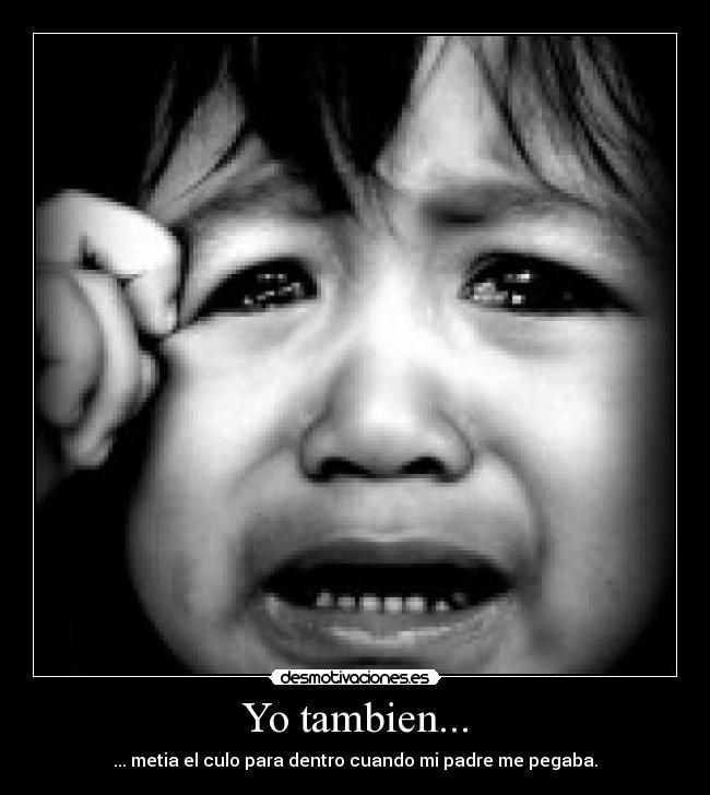 Yo tambien... - 