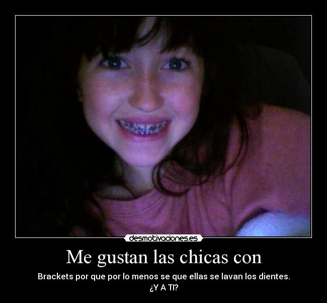 Me gustan las chicas con - Brackets por que por lo menos se que ellas se lavan los dientes.
¿Y A TI?