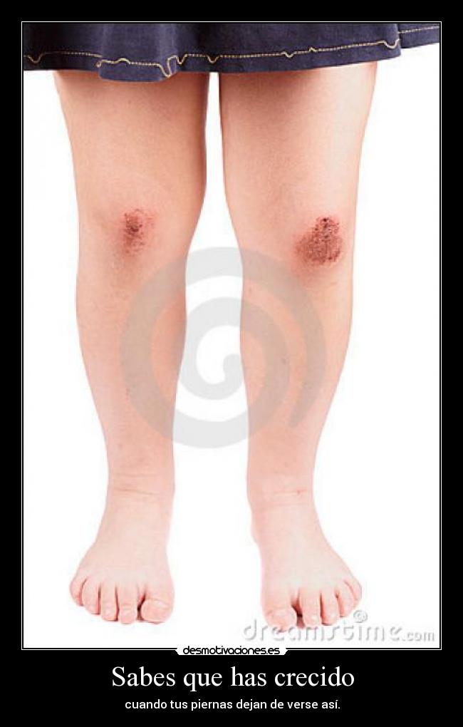 Sabes que has crecido -