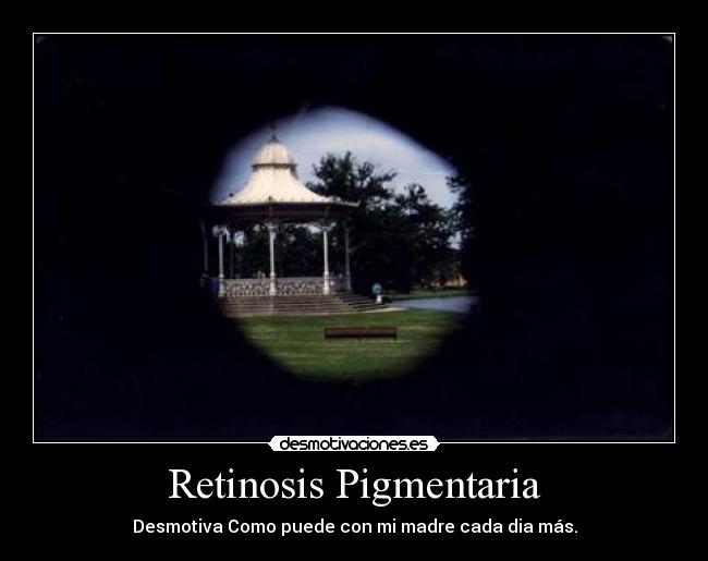 Retinosis Pigmentaria - Desmotiva Como puede con mi madre cada dia más.