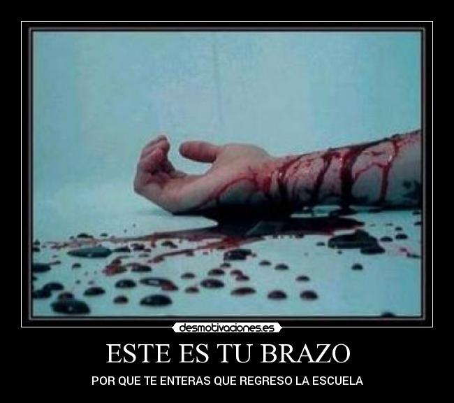 ESTE ES TU BRAZO - 
